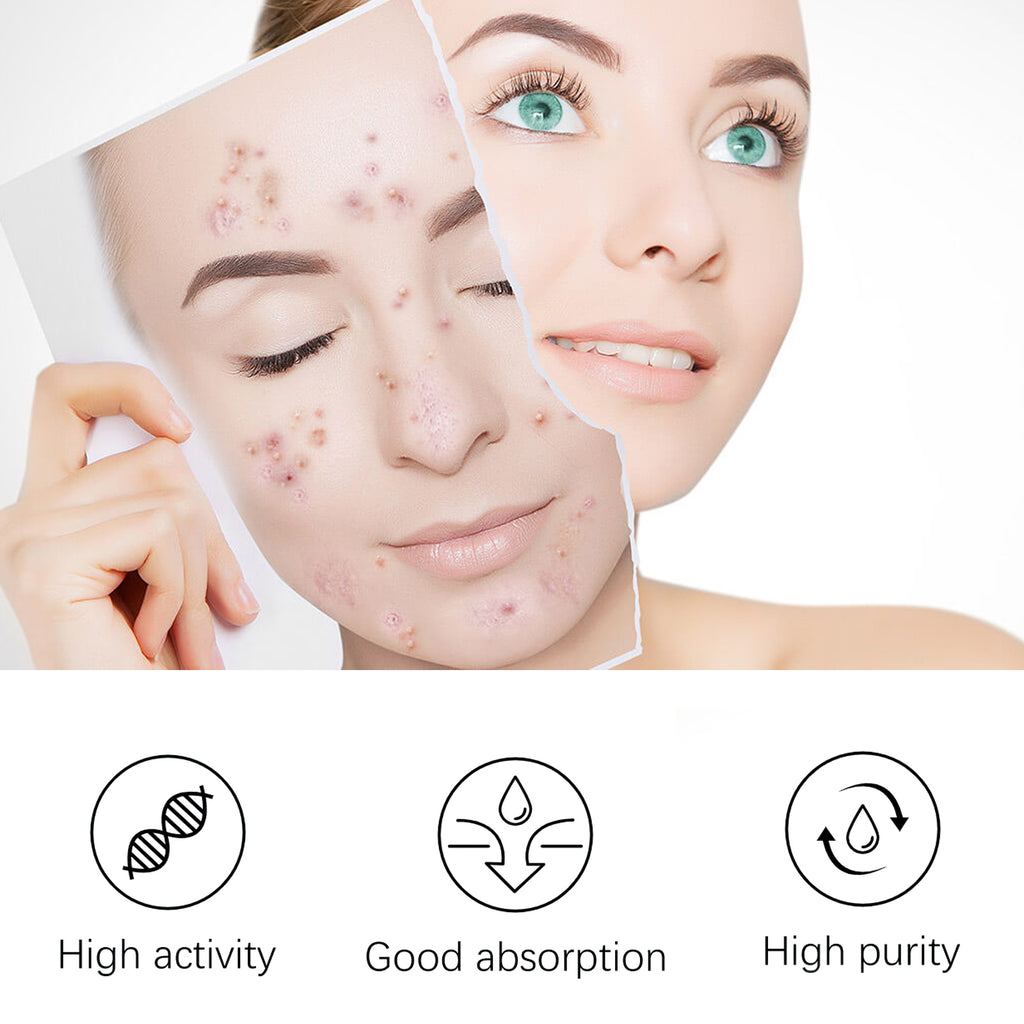 Tea Tree Whitening Acne Repair Relief Serum, Desalt Blain Acne Clean And Tighten Pores Moisturizing Essence