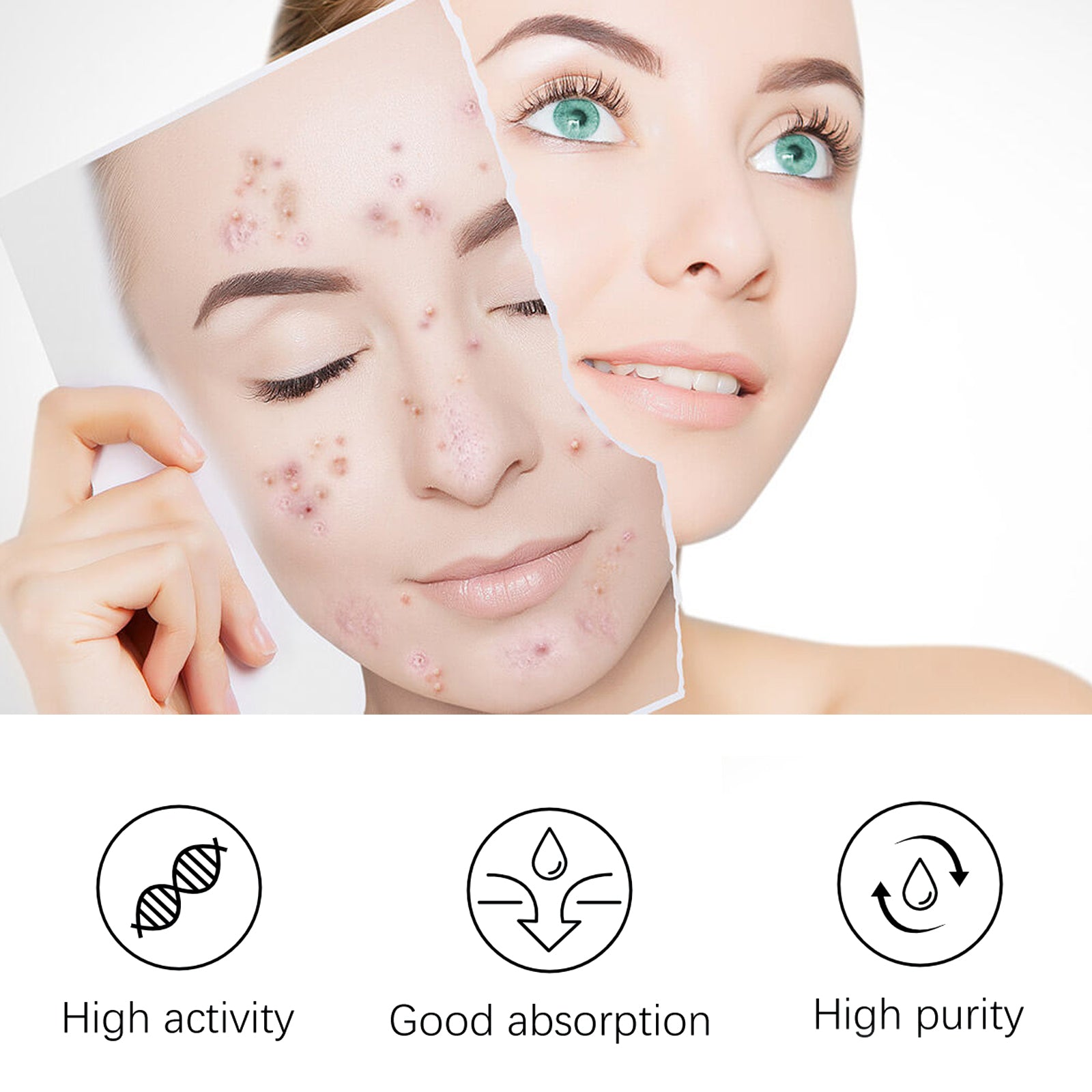 Tea Tree Whitening Acne Repair Relief Serum, Desalt Blain Acne Clean And Tighten Pores Moisturizing Essence